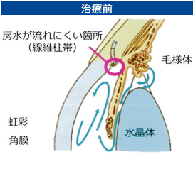 治療前